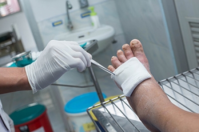 Enhancing Healing for Diabetic Foot Ulcers